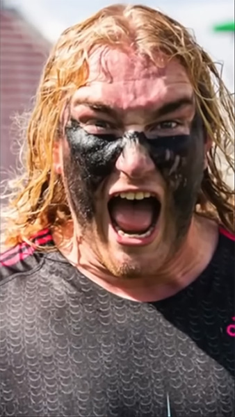 Purpose and Benefits of Eye Black in Lacrosse Purpose and Benefits of Eye Black in Lacrosse
